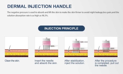 DerMashine IV tightens skin